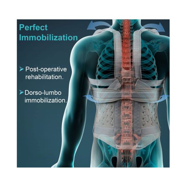perfect immoblilization