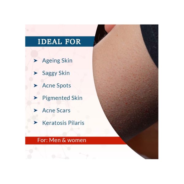 ideal for
