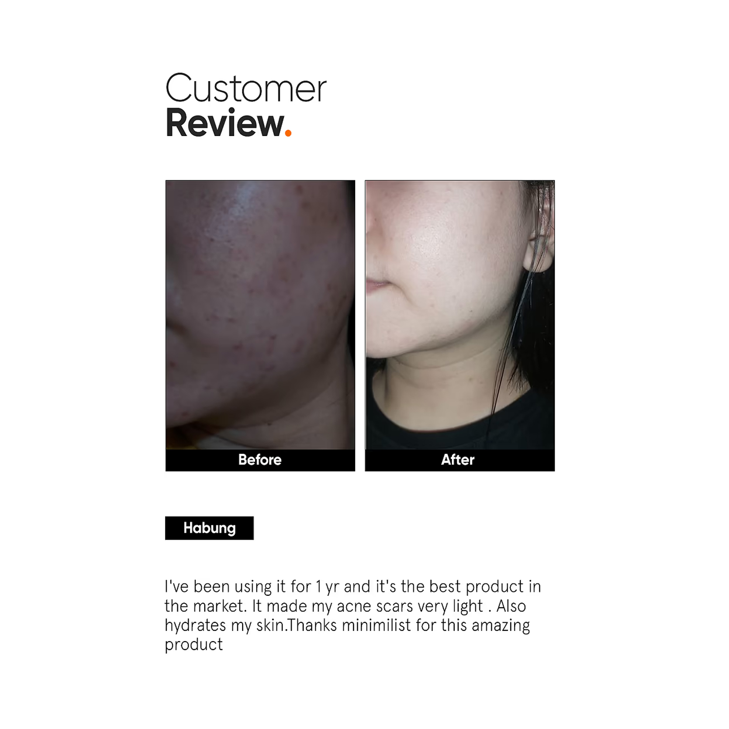 Alpha-Arbutin-2%-Face-Serum-5