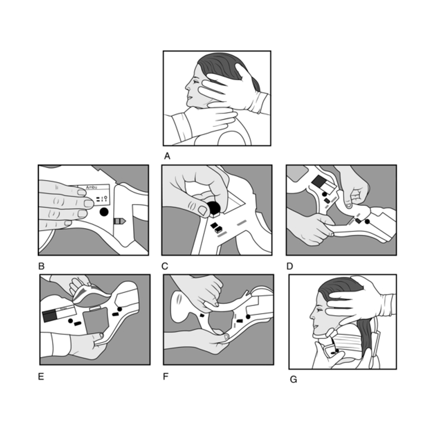 Dynamic-immobiliser-3 (1)