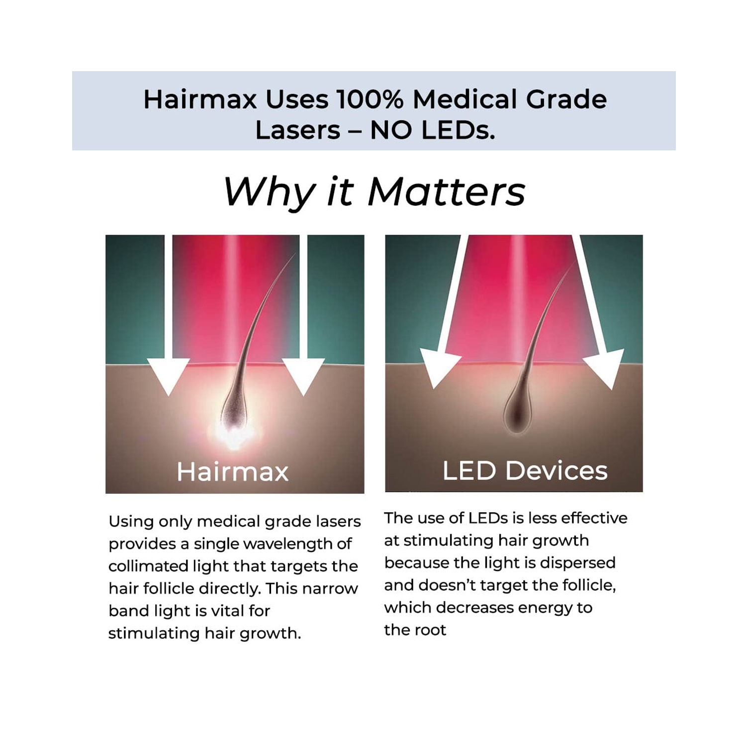 Hairmax-Laser-band41-3