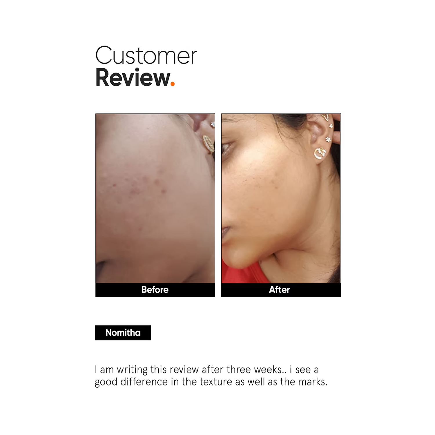 Minimalist-face-peel-5