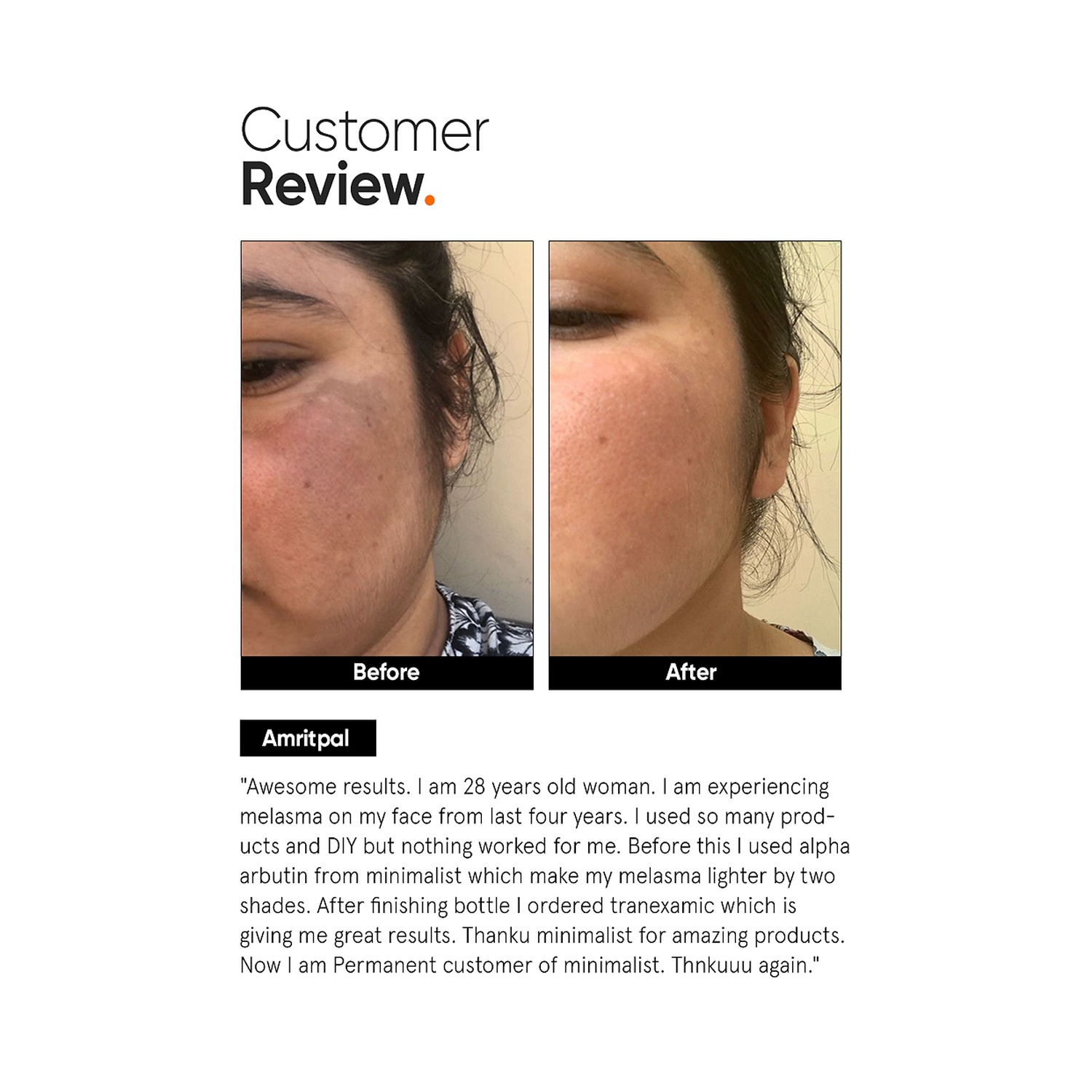 Tranexamic-3%-Face-Serum-5
