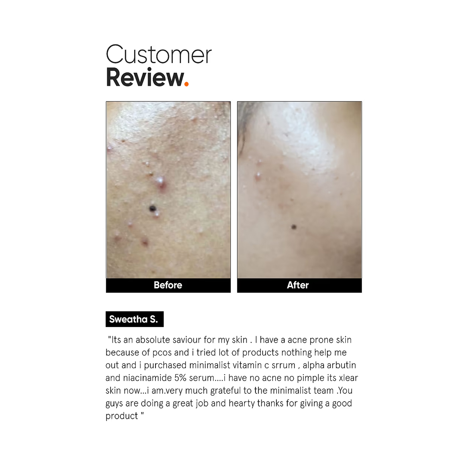 Vitamin-C-10%-Face-Serum-5