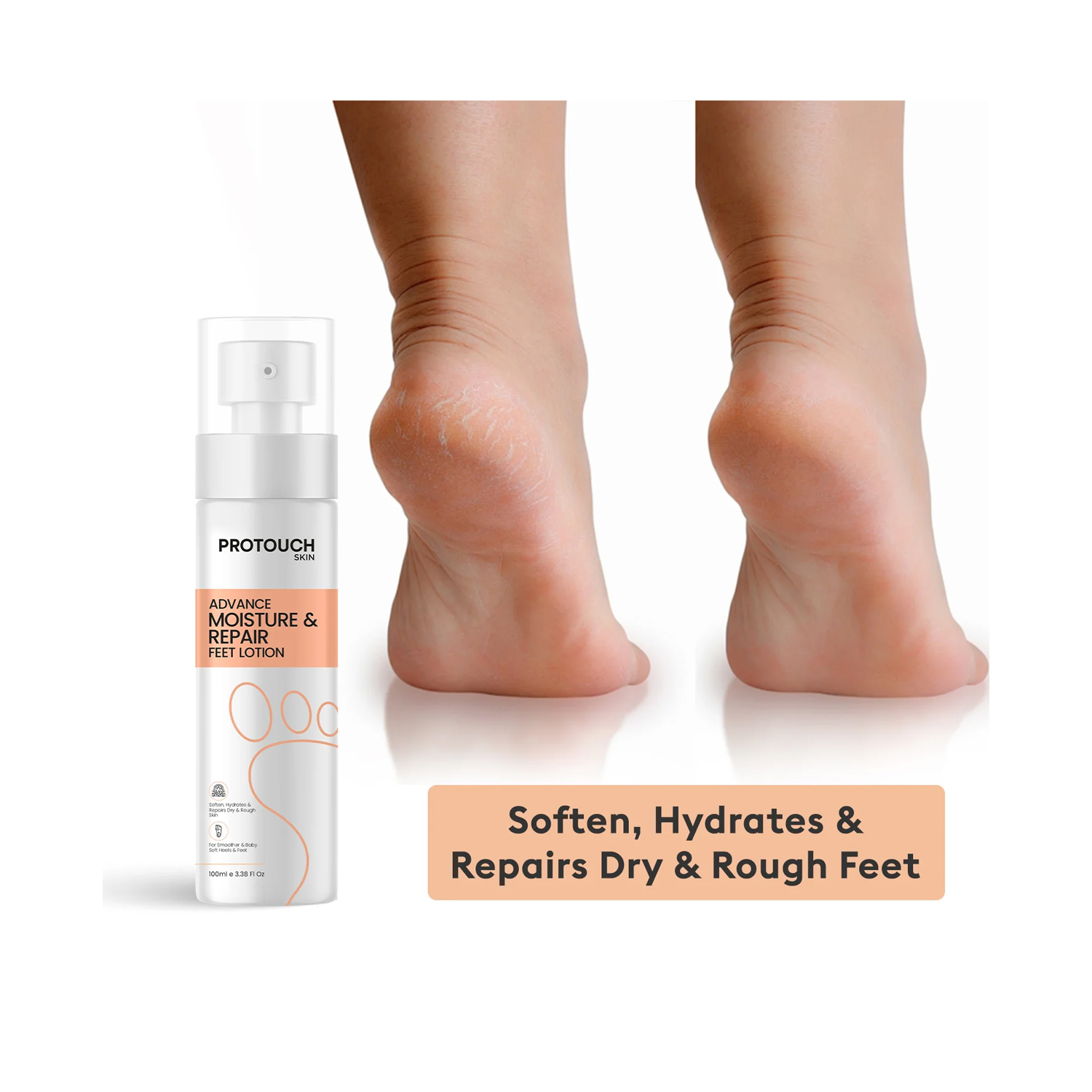 Advance-Moisture-&-Repair-Feet-Lotion-4