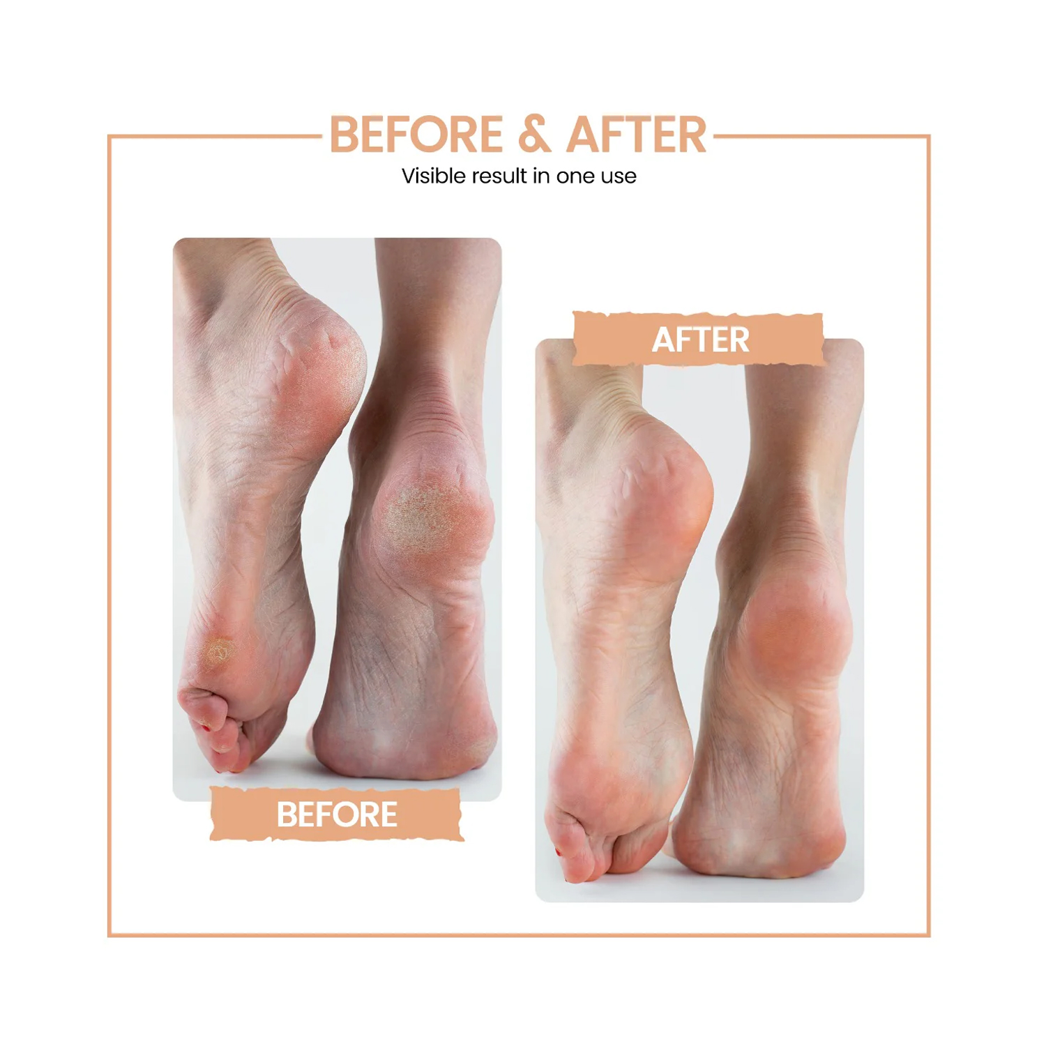 Protouch-callus-remover-5