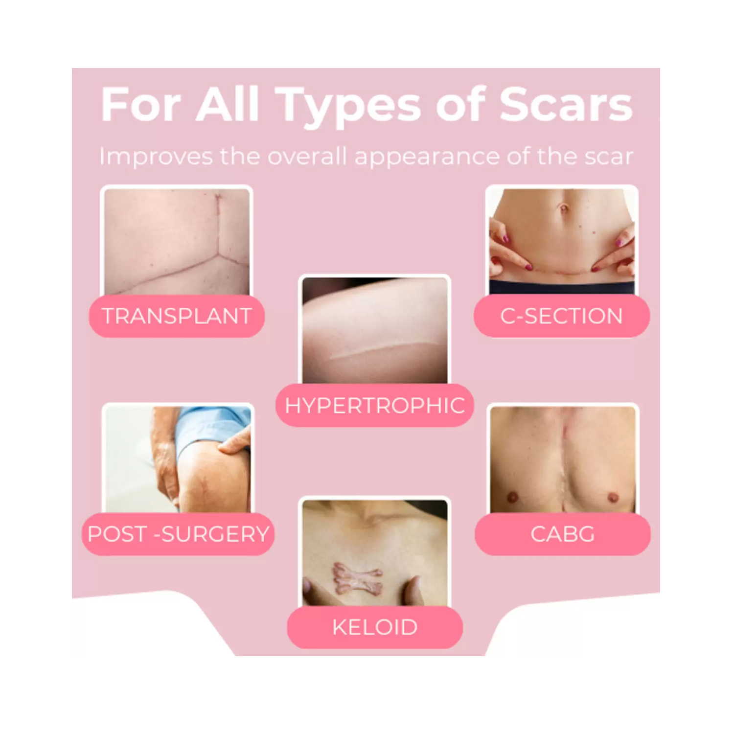 SCARXGEN-SILICONE-GEL-SHEET-12cm-x-15cm-3