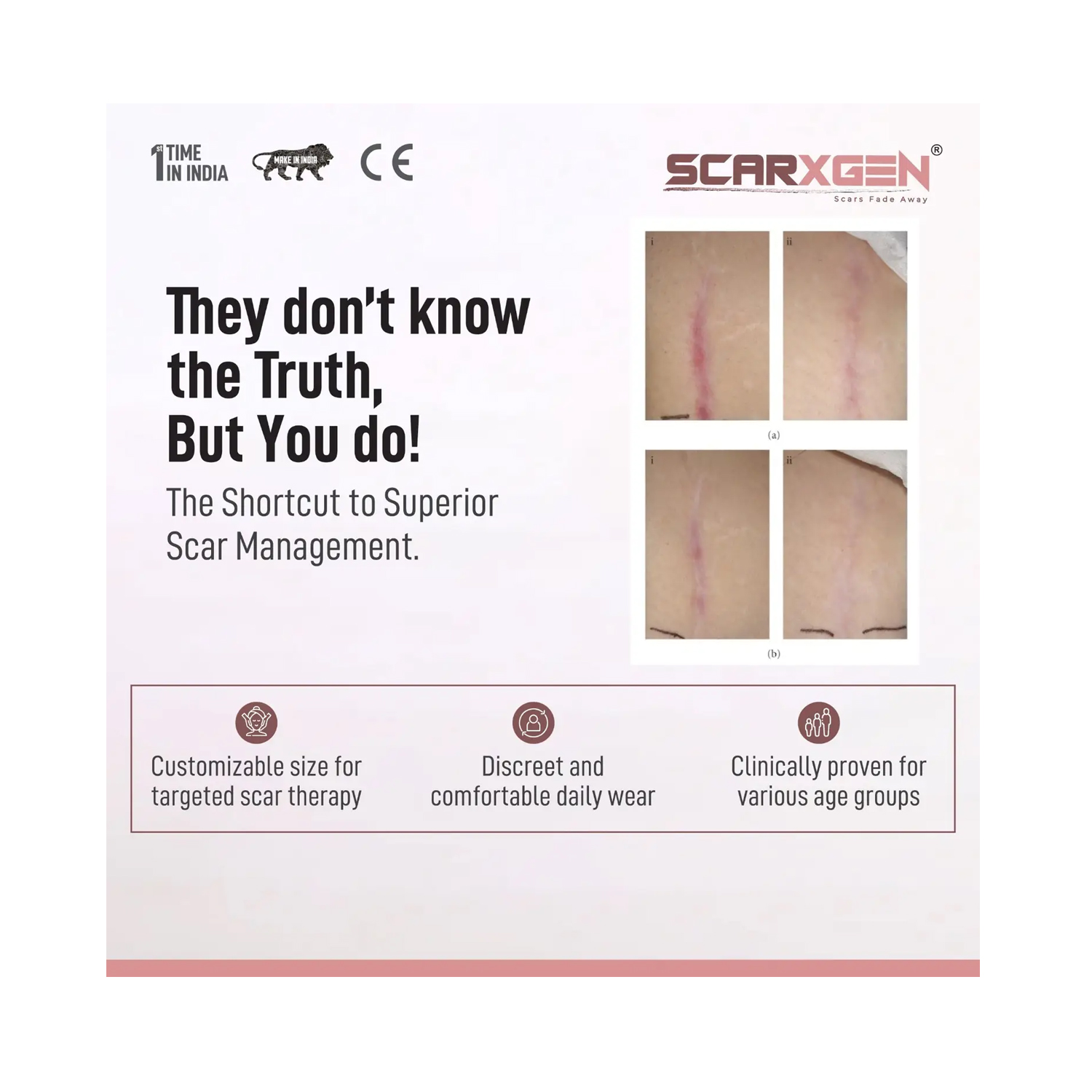 SCARXGEN-SILICONE-GEL-SHEET-15cm-x-15cm-5