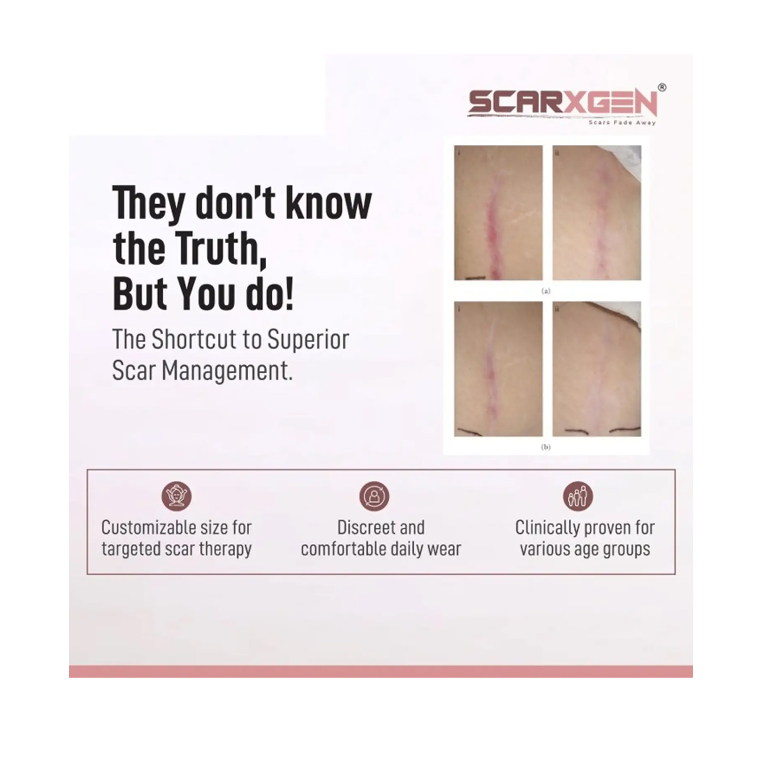 SCARXGEN-SILICONE-GEL-SHEET-5cm-x-5cm-4
