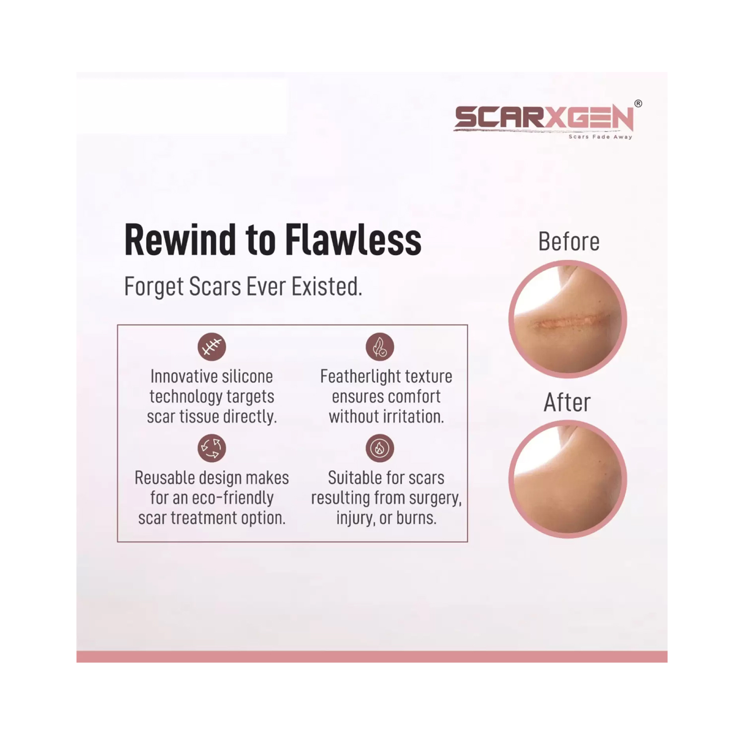 SCARXGEN-SILICONE-GEL-SHEET-5cm-x-5cm-5