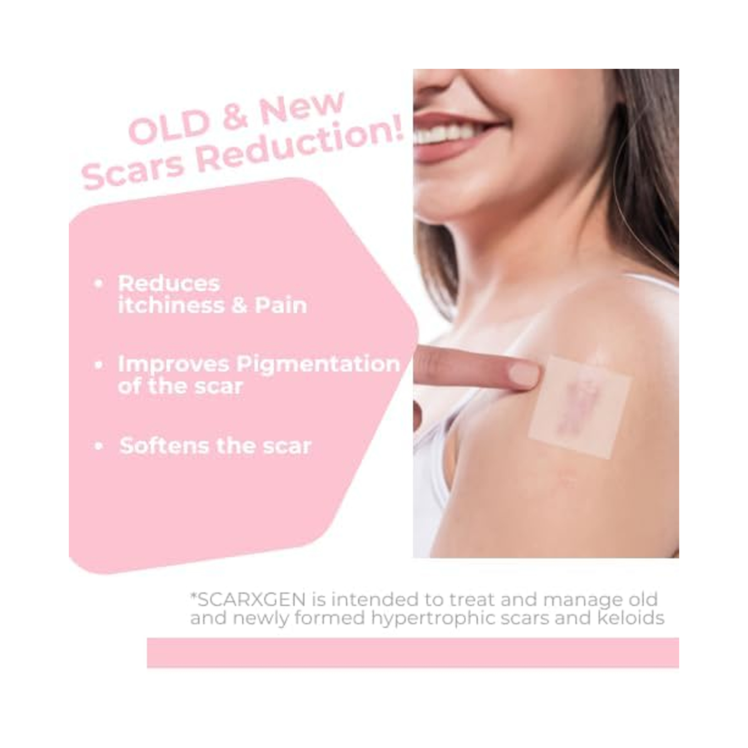 Scarxgen-Silicone-Gel-Sheet-10cm-x-10cm-2